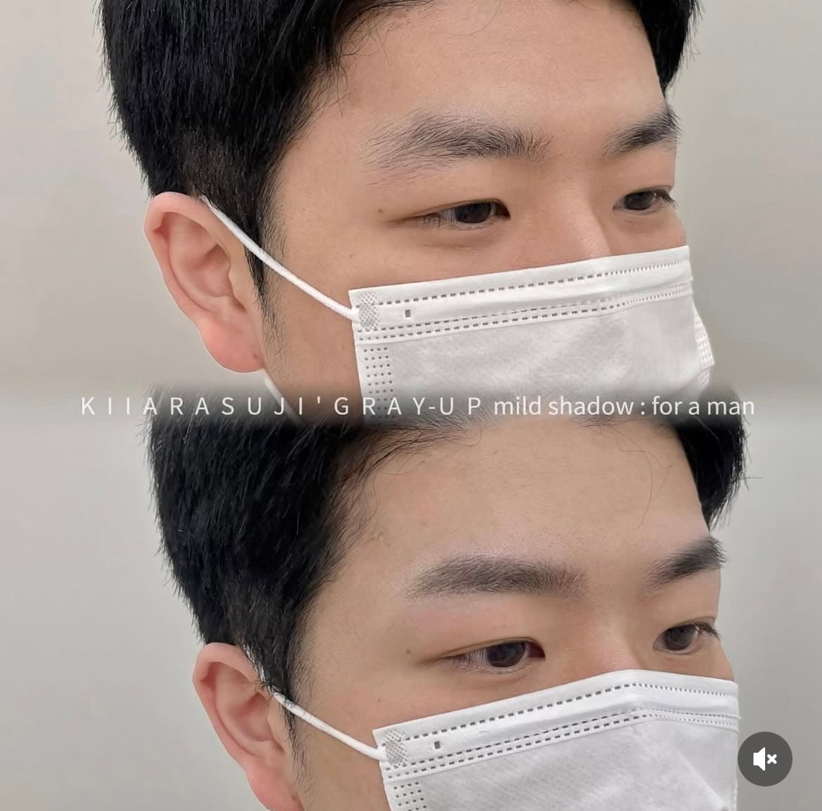 남자 눈썹 시술 1