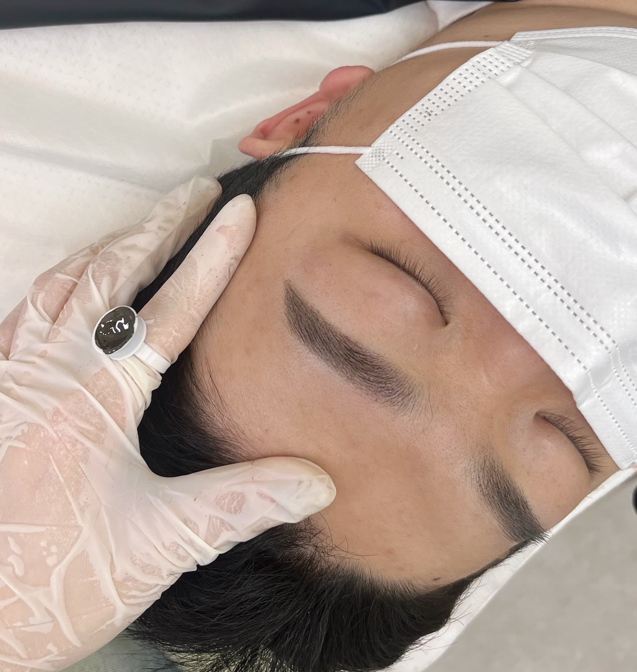 남자 눈썹 시술 3